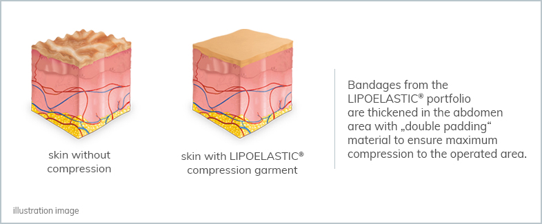 5 tips how to choose the best compression garments 